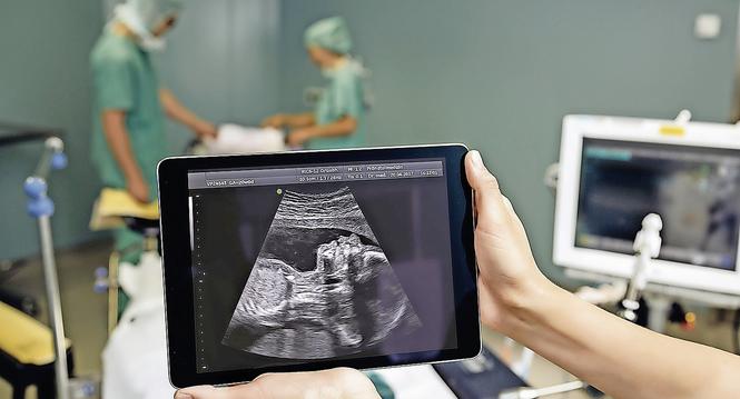 Hands holding a digital tablet showing an ultrasound image of a fetus in surgery room